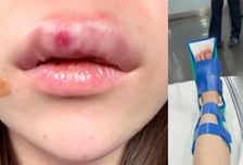 여친 기절시키고 심폐소생술 후 또 폭행…이별 통보에 흉기 난동