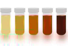 소변 보고 오더니 '노랗게' 질렸다...색깔로 보는 건강 상태 [한 장으로 보는 건강]