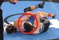 역대급 '자해 자작극' 논란, 女 레슬링 "상대 실격시키려 자기 팔 물어"... "중계 화면에 딱 걸렸다"