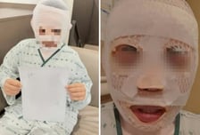 잠자는 태국인 아내 얼굴에 끓는 물 부은 40대…징역 3년 구형