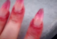 "네일아트 부작용" 진단서엔 근육통?…40만원 달라던 외국인, 알고보니