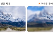 "치료시기 놓치면 실명" 2030 젊은환자 늘었다...위험인자 뭐길래