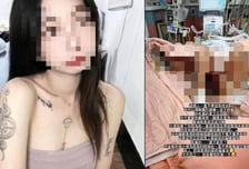 "배설물이 강 이뤄...입·코에서 피 흘려" 중환자 몰래 찍고 조롱한 간호사