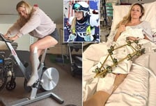 '충격' 다리 절단 위기→대수술 연속 5번→불과 한 달 만에 벌써? 세계가 놀란 회복력 "고통스럽지만..."