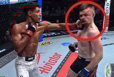 충격 "턱뼈 박살나도 1억 벌었어" UFC 스타, 구급차서 "수프 먹으면 돼" 멘탈갑... "예쁜 여친 있어 행복"