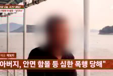 "아직 안 죽었냐" 70차례 무차별 폭행...얼굴뼈 조각 난 택시기사 '의식불명'