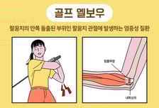 "골프채 잡아본 적도 없는 엄마가?"...팔꿈치 '찌릿' 골프엘보 원인은