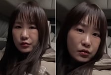 "확 달라진 얼굴"...김지민 퉁퉁 붓고 멍 잔뜩 '깜짝', 무슨일?