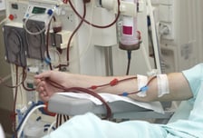 콩팥환자 생사 가르는 혈액투석, '이곳'서 받으니 사망 위험 10%↑