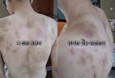 "5년 만에 탈출" 직원 감금·폭행한 부산 중식당...온몸에 멍 '끔찍'