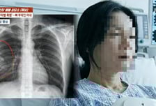 자녀 앞에선 다정한데..."시부모 제사를 잊어?" 남편 폭행에 갈비뼈 골절