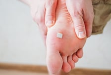 "티눈 치료만 2500번" 보험금 7억 받은 40대…대법 "문제 없다"