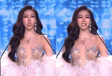 미인대회서 자기소개 중 치아 '툭'...관객들 오히려 박수 친 사연