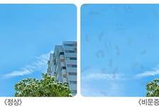 "눈앞에 날파리 떠다녀" 단순 비문증 아니었다? 넷 중 1명 '이 병' 있다