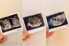 '46세' 김민경, 결혼 2년만 임신…"이 나이에 임밍아웃할 줄이야"