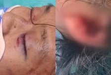 故김창민 감독이 홀로 키운 子, 불안정 상태...가해자는 유튜브 출연
