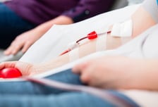 투석환자의 '생명줄' 혈관, 좁아지면 넓히면 끝? "혈관 수명 늘려야"