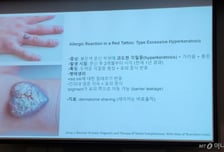 '피부과학회 인증 문신업소' 생길까…피부과 의사들이 꺼낸 문신사법 대책은