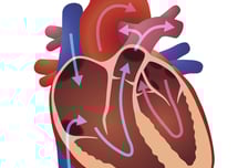 "심장에 관 넣지 않아도 돼" 삼첨판막역류, 심장 MRI로 중증도 본다