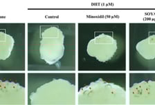 오가노이드사이언스, 코스맥스와 남성형 탈모 재현 플랫폼 공동개발