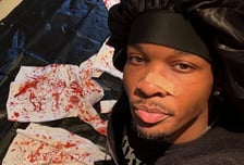 14세 소녀와 성관계 드러날까봐?…'엠카' 출연 가수, 살해 혐의 기소