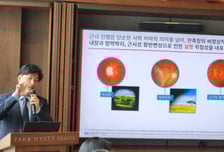 "안경 안 쓰려면 나가서 뛰어놀아야" 아이 시력 관리하는 뜻밖의 방법