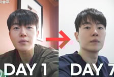 단 7일인데…자연스레 먹던 식단의 충격, '피부 5살 급노화'