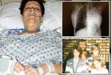 '아빠 외투' 입다가 폐암 걸린 딸...옷에 묻은 '회색먼지' 정체