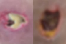 마사지받다 잠들자 "멋대로 불법시술"...피부 괴사→절제, 무슨 일?