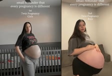 "또 쌍둥이 임신했더니 배 이렇게 부풀어"…2200만 영상 조회 '폭발'