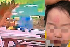 "두 발 뜰 정도" 2살 아이 머리 내려친 60대…"어린이날이 악몽 됐다"