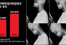 254만명 앓는 '국민질환'…10년새 35% 늘었다