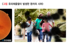 폰 달고 살더니..."앞이 안 보여" 실명 부르는 이 질환, MZ 세대 덮쳤다