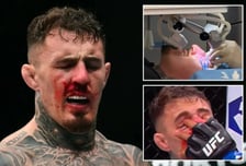 충격 "4분 동안 눈 3번 찔렸다" UFC 챔피언, 피눈물에 분노할 만... "수술 2번 받았는데 복귀 좌절"