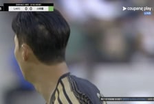 "손흥민 원형탈모야?" 뒷머리 사진에 깜짝…직접 밝힌 입장