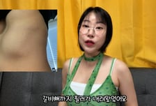 "가슴 4개 됐다" 이세영, 성형에만 '1억' 썼는데 부작용 호소