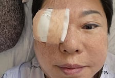 양희은, 각막이식 수술 받았다…눈 상태 묻자 "두고 봐야 한다"