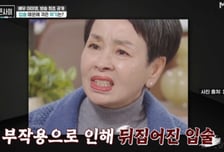 이미영 "공업용 실리콘 시술에 입술 다 뒤집어져…일 다 끊겼다"