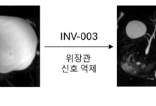 인벤테라, 경구용 MRCP 조영제 비임상 패키지 완성…임상 진입 본격화