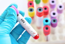 한국인 HIV 신규 감염 600명대 '20년만 최저'…감염자 66%가 2030