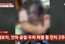 깜빡이 켰을 뿐인데…"기분 나빠" 문 벌컥 열고 택시 기사 무차별 폭행