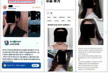 "윤곽이랑 코수술 2000% 만족해요"…알고보니 성형외과 뒷광고였다
