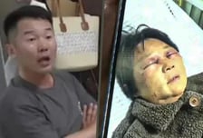 "며느리가 폭행" 시모 눈 퉁퉁, 갈비뼈 부러져...中서 황혼육아 갈등