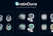 "MRI 긴 대기 시간 줄인다"…뉴블에이아이, 4억 시드투자 유치
