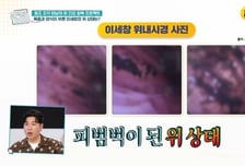 이세창, '피범벅' 위내시경 사진 공개…"소주 10병→2병 줄여"