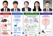 전남대 줄기세포분비체연구단·GIST 이코노어연구단, 뇌졸중 치료 가능성 제시