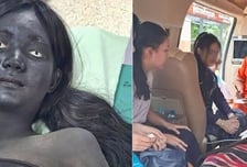 응급실에 온몸 까만 귀신 환자가?…태국 구조대 놀라게 한 여학생