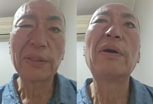 '8번 결혼' 유퉁, 눈 안 감기고 입 돌아가…'안면마비' 안타까운 근황