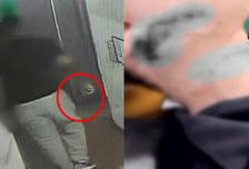 "뭘 봐" 출소 한달만 또 맥주병 휘둘러…얼굴·목 찔린 20대 괴사 우려