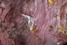 샐러드에 유리조각이..."내가 일부러 넣었냐" 되려 큰소리친 점주